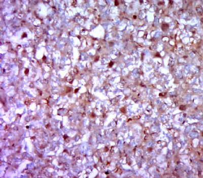 RASSF1A antibody