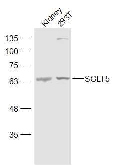 SLC5A10/SGLT5 antibody