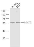 SLC5A10/SGLT5 antibody