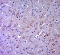 GPR49/LGR5 antibody