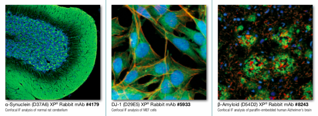 神经类抗体免费试用，伴你我成长