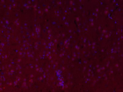 Cardiac Troponin I/TNNC1心肌肌钙蛋白抗体