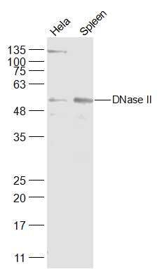 DNase II antibody