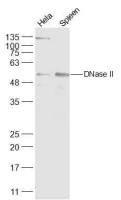 DNase II antibody