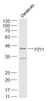 P2Y1 antibody
