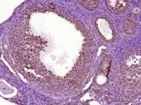 Nanog胚胎干细胞关键蛋白抗体