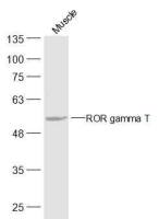ROR gamma T antibody