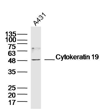 Cytokeratin 19细胞角蛋白19抗体