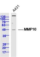 MMP10 antibody