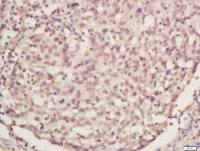 phosphos-PCNA (Tyr211) antibody