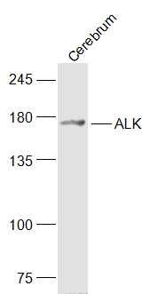 ALK antibody