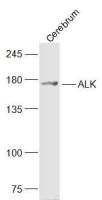 ALK antibody