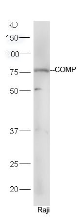 COMP软骨寡聚基质蛋白抗体