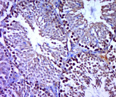SREBP2 antibody