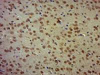 SOX2 antibody