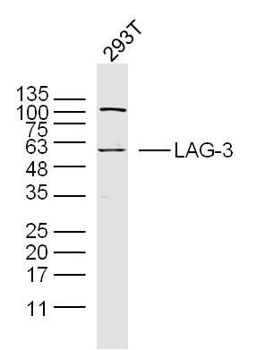LAG-3 antibody