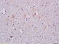 ganglioside GM1 antibody