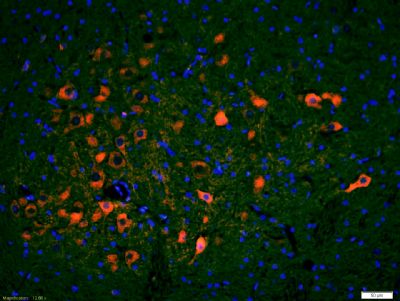 Phospho-IRF3 (Ser396) antibody