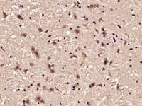 phospho-Akt (Thr450) antibody