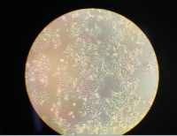 人宫颈癌肠转移细胞/人宫颈癌上皮细胞CaSki