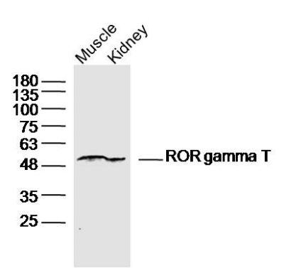 ROR gamma T维甲酸相关孤儿受体γt抗体