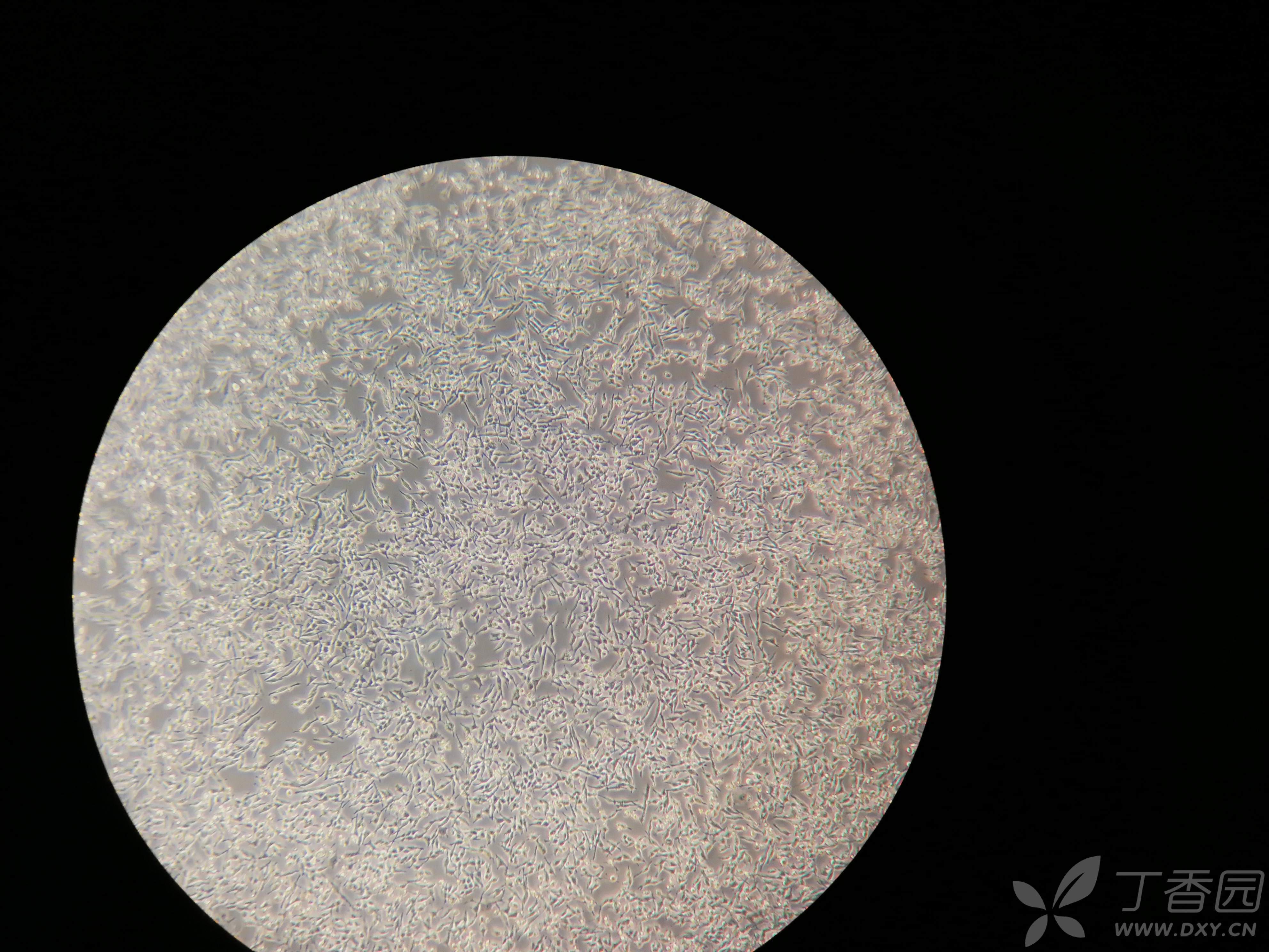 7细胞感觉状态还可以,但贴壁不牢 - 丁香园论坛