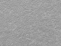 SPC-A-1人肺腺癌细胞