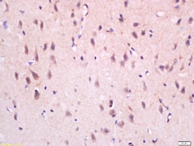 NGFB神经生长因子β抗体