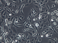 MDA-MB-231人乳腺癌细胞