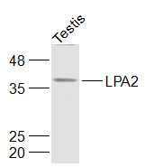 LPA2 antibody