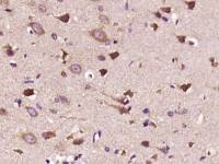 Phospho-5-Lipoxygenase(Ser271) antibody