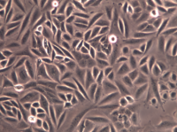 SiHa人子宫颈鳞癌细胞