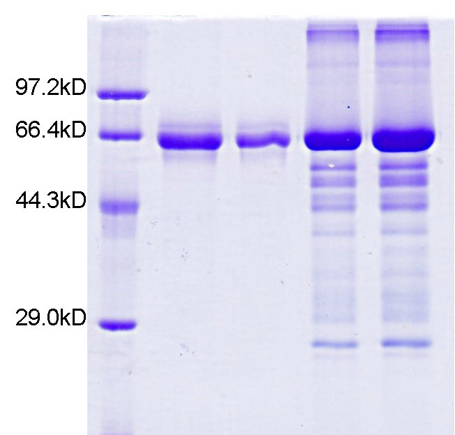 ASF1B重組蛋白表達