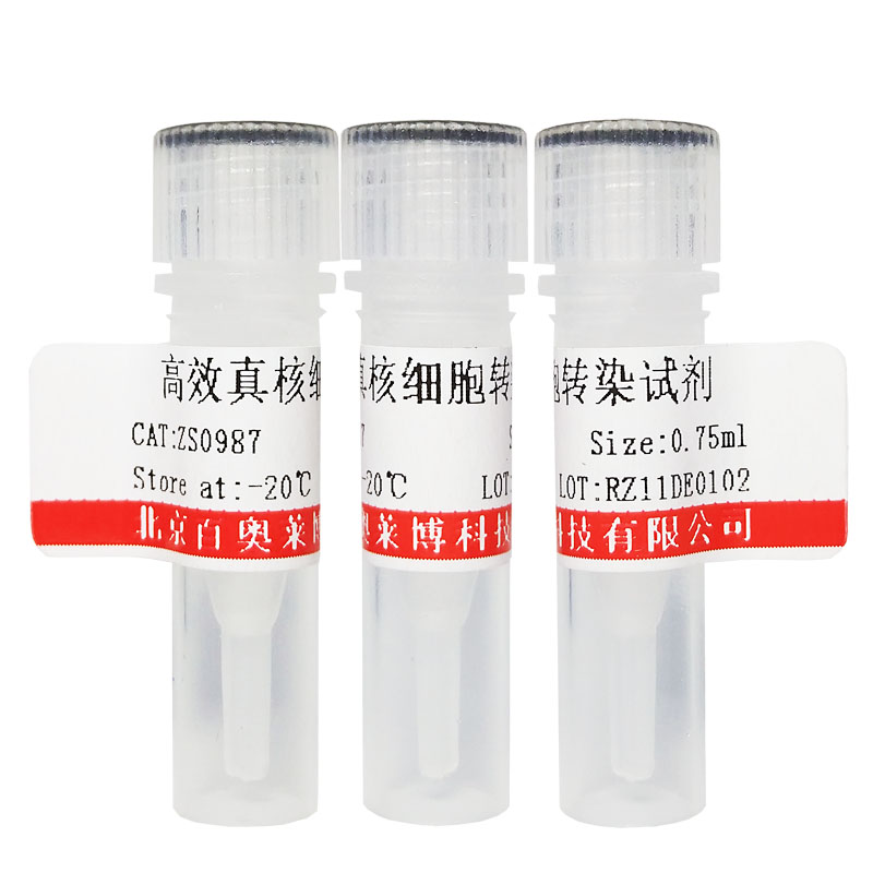 重组小鼠Semaphorin 4D(Sema4D)品牌产品图