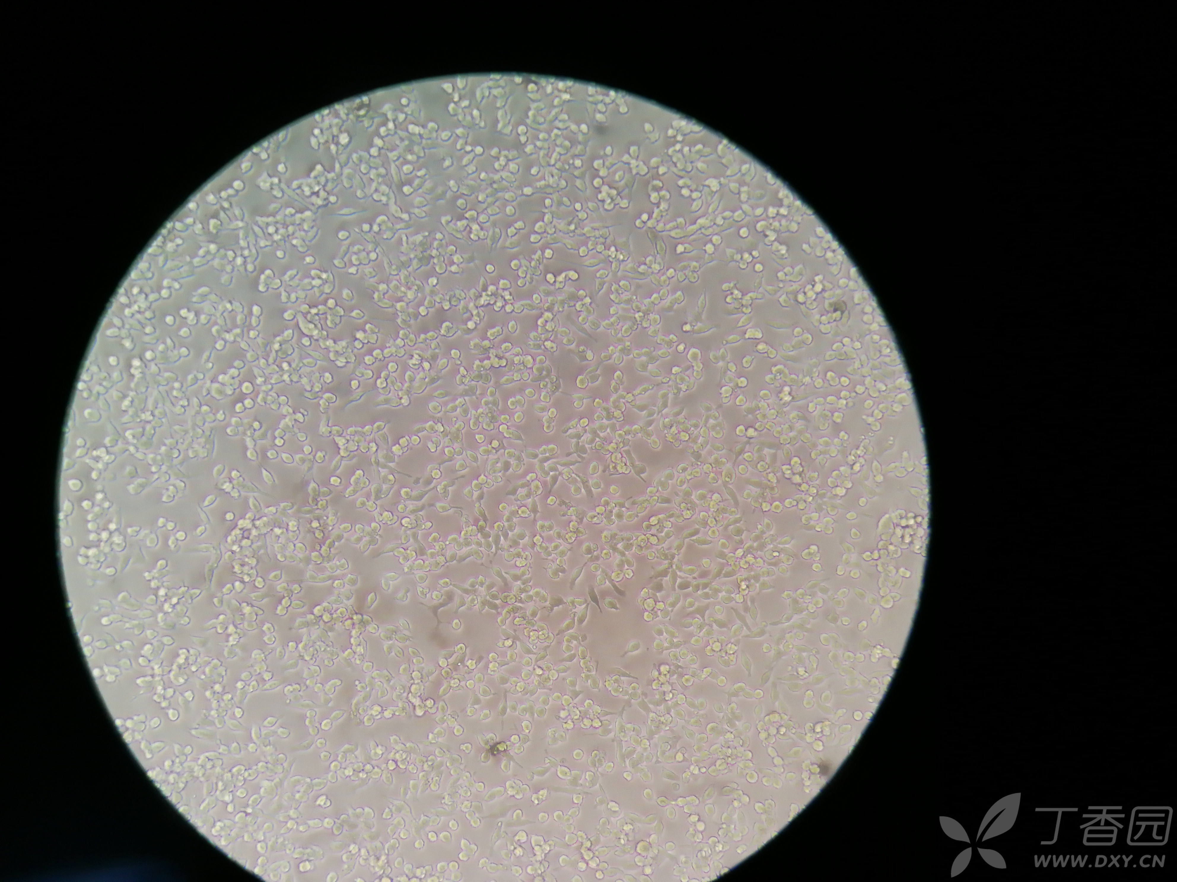 raw264.7细胞感觉状态还可以,但贴壁不牢