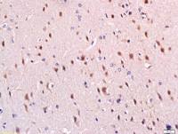 SPTBN2非红细胞血影脑蛋白β2/spectrin β III抗体