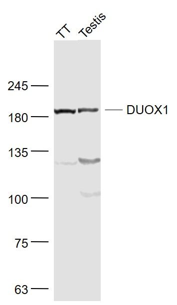 DUOX1双氧化酶1/甲状腺氧化酶1抗体
