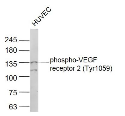 phospho-VEGF receptor 2 (Tyr1059) antibody