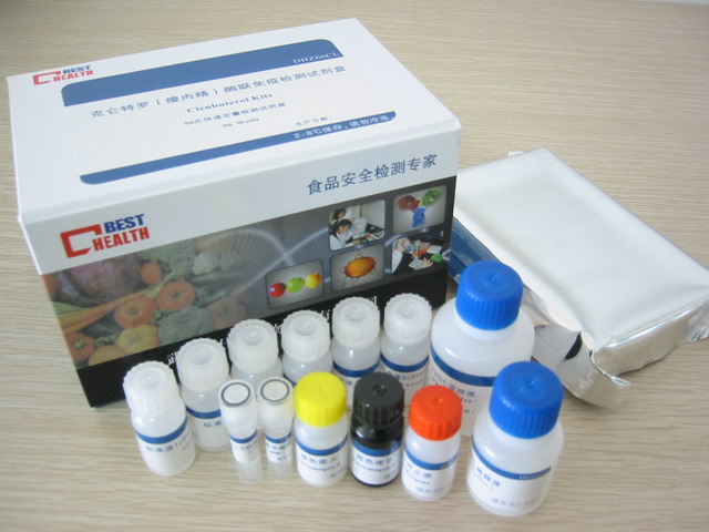小鼠TRAIL-R3 elisa检测试剂盒