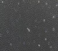 树突状细胞DC细胞