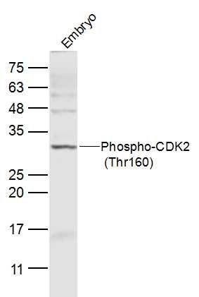 Phospho-CDK2 (Thr160) antibody