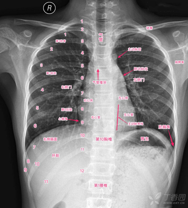 正常的肺片图片