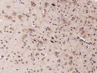Synaptopodin antibody