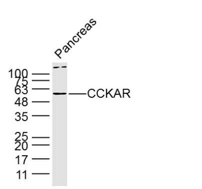 CCKAR胆囊收缩素A受体抗体