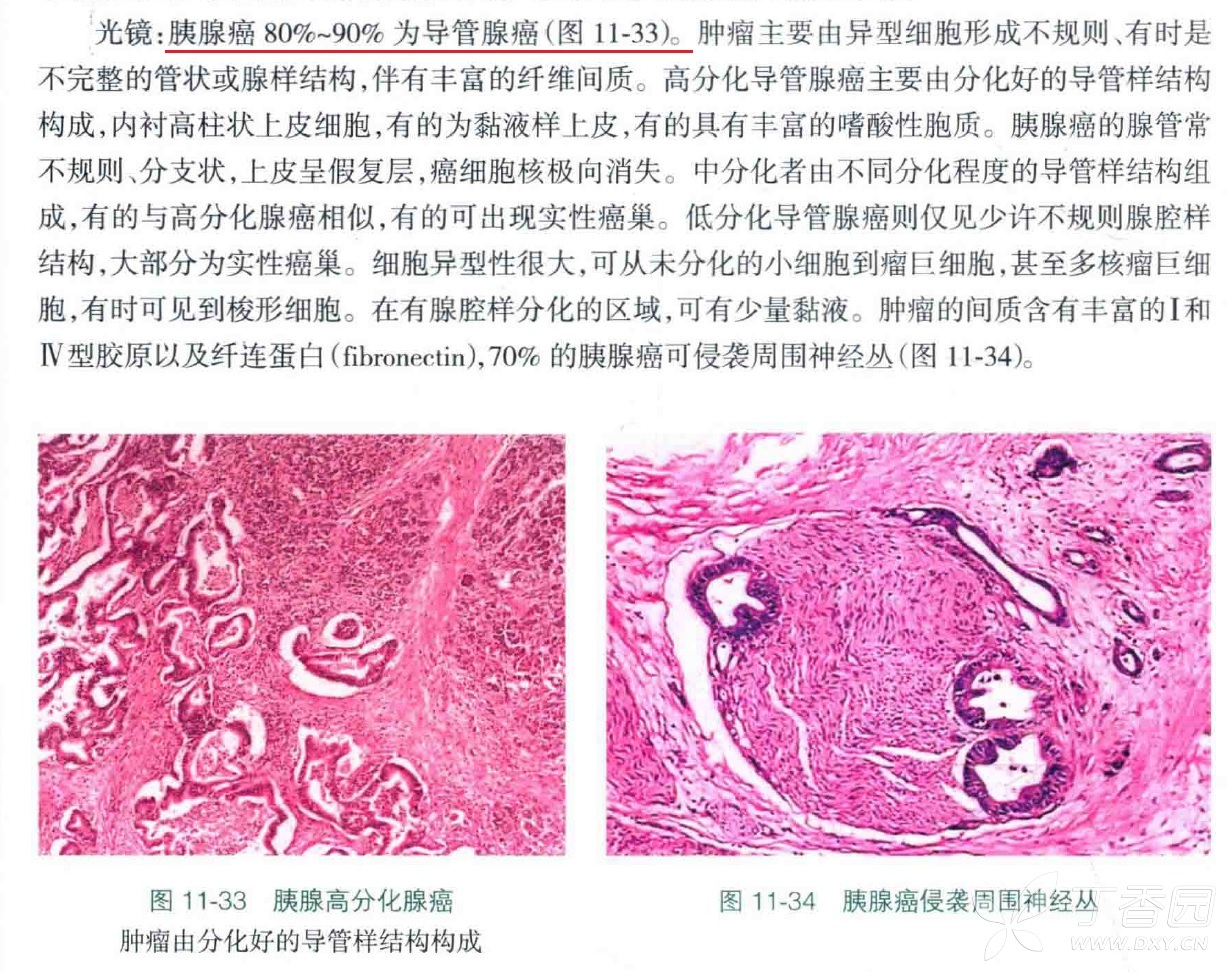 那么,经过简单的计算,即可得出,导管(细胞)腺癌占胰头癌的百分比介于