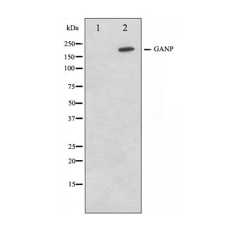 p130 Cas Antibody 多克隆抗体