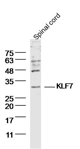 KLF7 KLF样转录因子7抗体