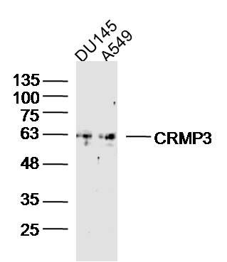 CRMP3二氢嘧啶酶相关蛋白3抗体