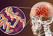 神经综述：登革病毒感染相关神经系统并发症