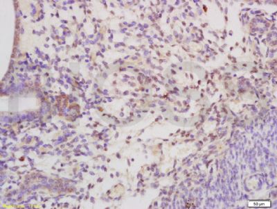 SHBG性激素结合球蛋白抗体